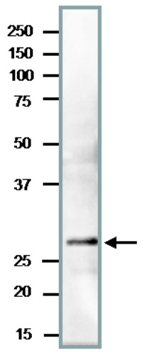 Western blot using anti-PCNA antibodies