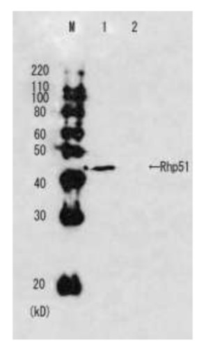 Western blot using anti-Rhp51 (s.pombe) antibodies