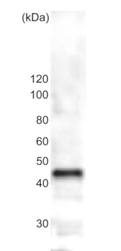 Western blot using anti-beta tubulin (yeast) antibodies