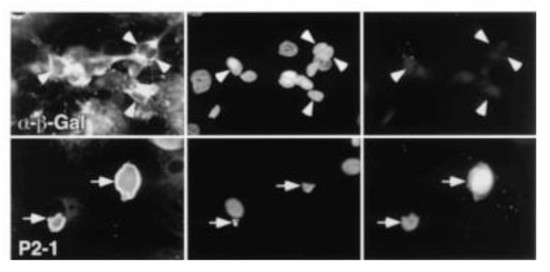 Immunolocalization using anti-ACP3 polyclonal antibodies