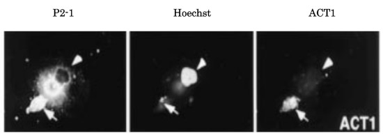 Immunolocalization using anti-APP-C31 polyclonal antibodies