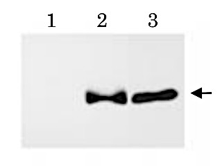 Western blot using anti-APP delta C31 polyclonal antibodies