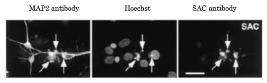 Immunolocalization using anti-APP delta C31 antibodies