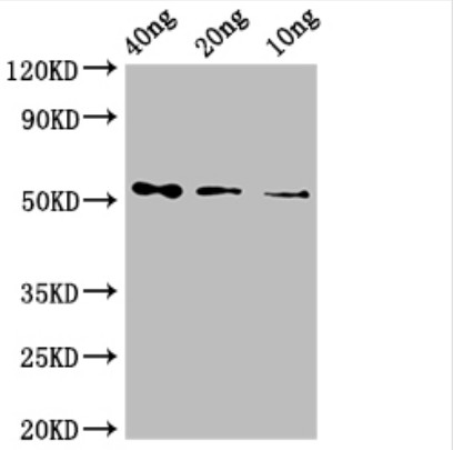 Western blot using anti Nucleoprotein N antibodies