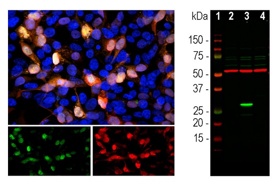 Immunolocalization and western blot using anti-GFP rabbit polöyclonal antibodies
