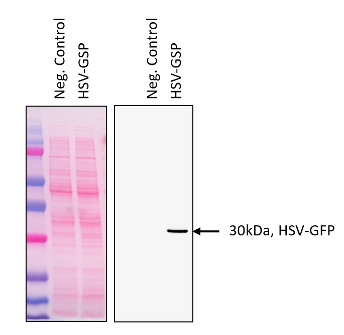 Western blot using anti-HSV epitope tag antibodies