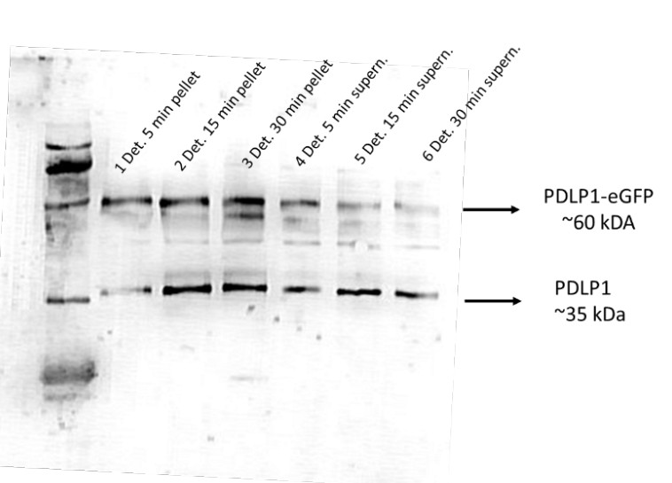 Western blot using anti-PDLP1 antibodies