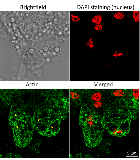 Immunofluorescent localization of plant actin in rice protoplasts using anti-plant actin monoclonal recombinant antibodies