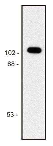 Western blot using anti- beta galactosidase from E.coli moncoclonal antibodies