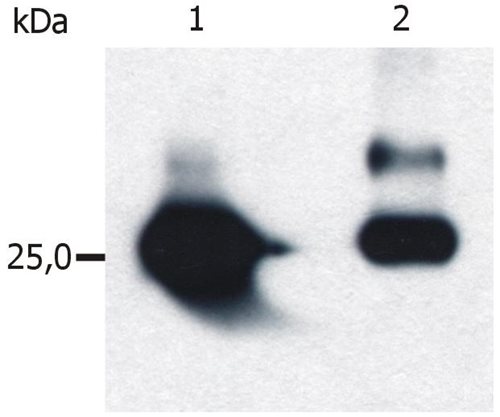 Western blot using anti-GST tag monoclonal antibodies