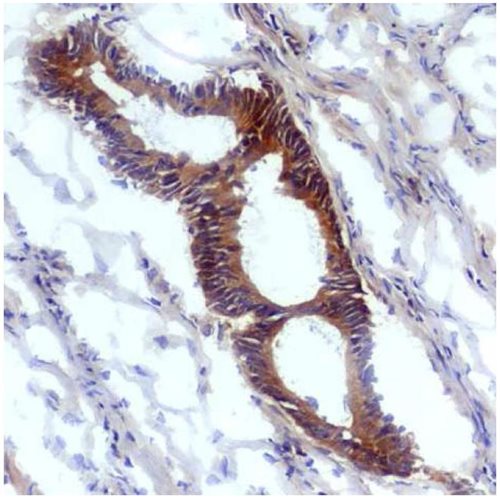 IHC using mouse monoclonal anti-nitrotyrosine antibodies