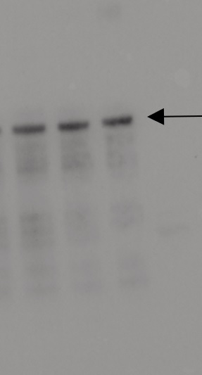 Western blot using anti-ASY1 antibodies