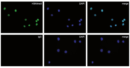 Immunofluorescence using rabbit IgG negative control