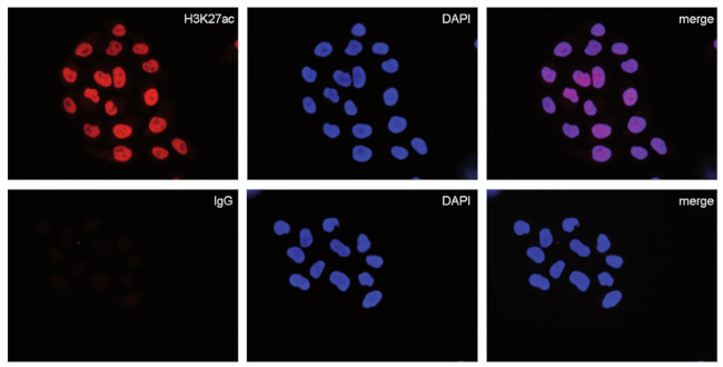 Immunofluorsescence using mouse IgG negative control