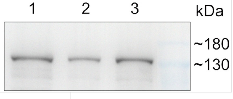 Western blot using anti-GUN5 antibodies