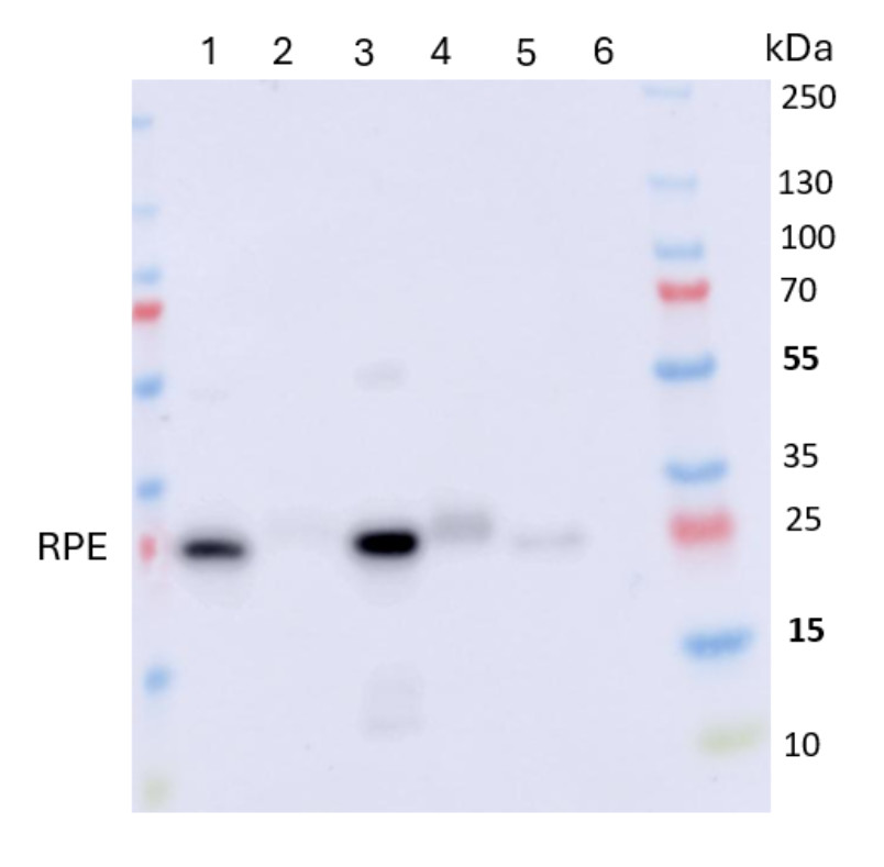 Western blot using anti-RPE antibodies