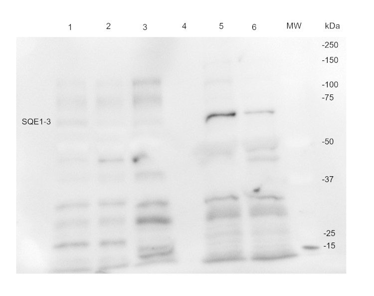 Western blot using anti-SQE1-3 antibodies