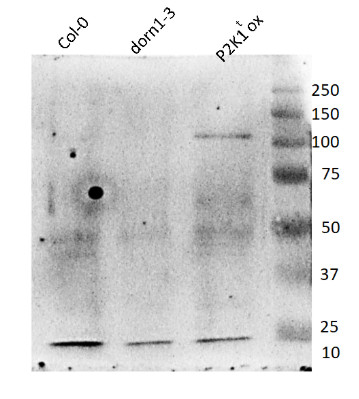 Western blot using anti-P2K1 antibodies