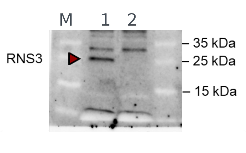 Western blot using anti-RNS3 antibodiesd
