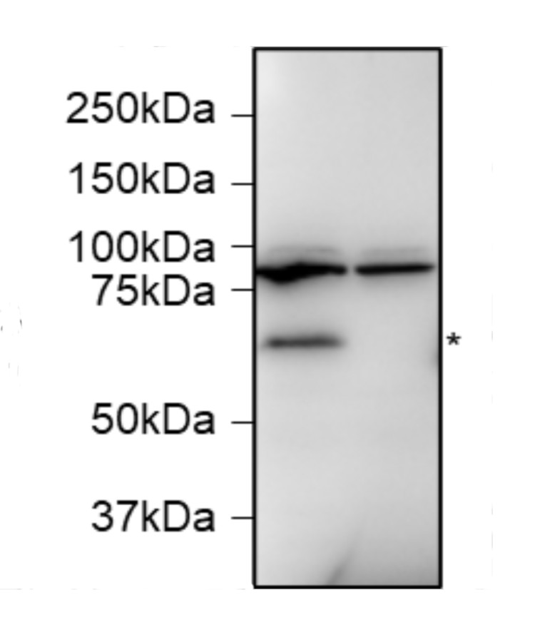 Western blot using anti-WRKY33 antibodies