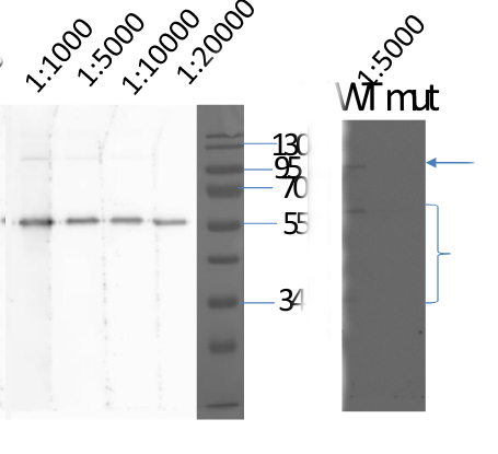 Western blot using anti-XLG2 protein antibodies