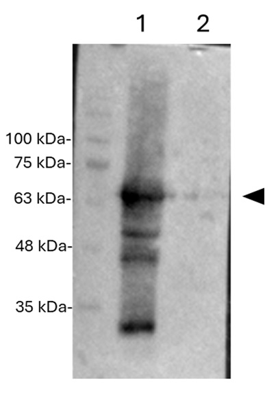Western blot using anti-tdTomato antibodies