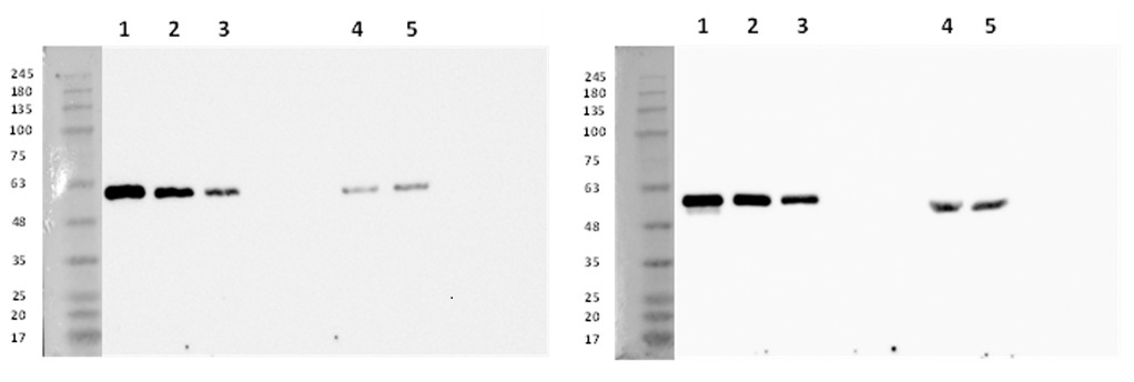 Western blot anti-CRT1/2