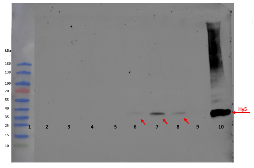 Western blot detection of plant HY5