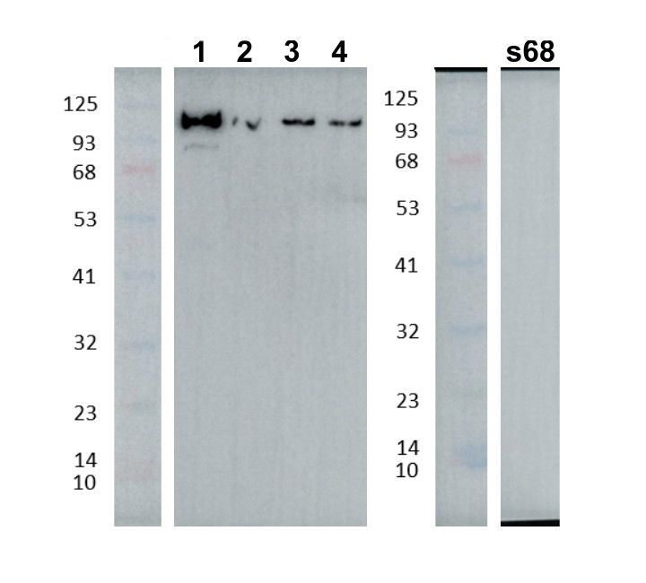 Western blot using anti-AARE antibodies