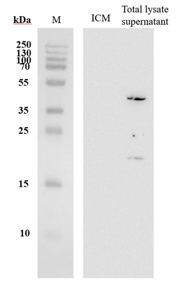 Western blot using anti-NhaD antibodies