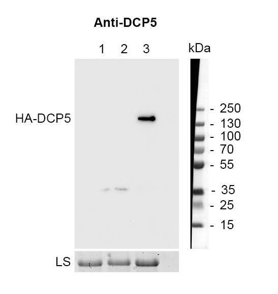 Western blot using anti-DCP5 antibodies