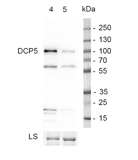 Western blot using anti-DCP5 antibodies