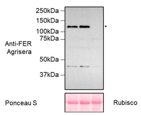 Western blot using anti-FERONIA antibodies