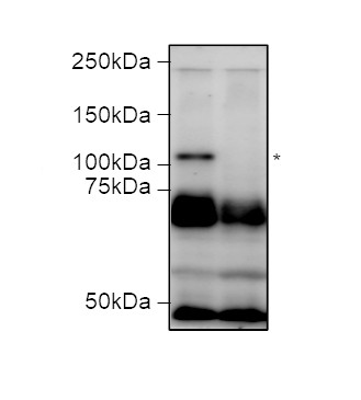 Western blot using anti-FERONIA antibodies
