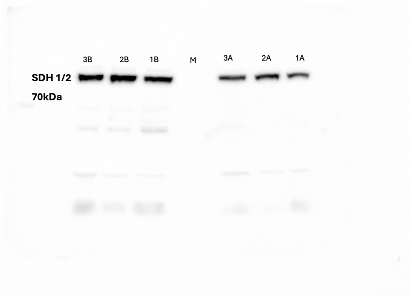 Western blot anti-SDH1/2 antibody
