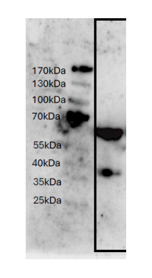 Western blot using anti.plant ALDH2 antibodies