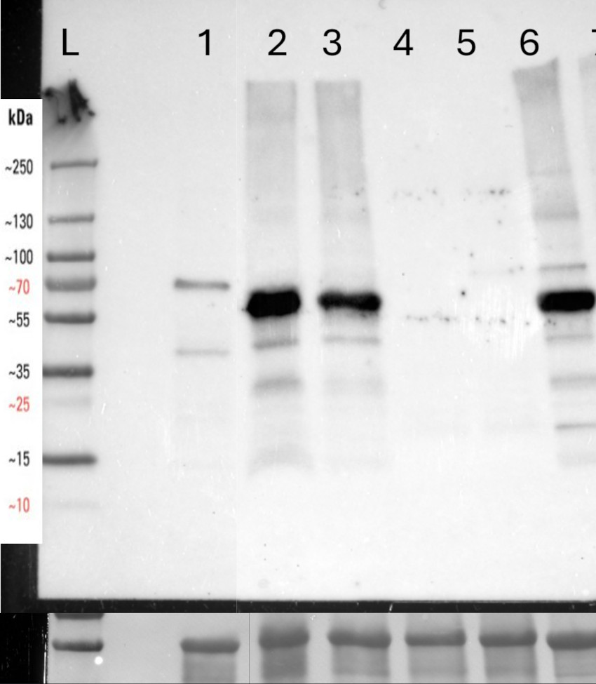 Western blot using anti-catalase 3 antibodies