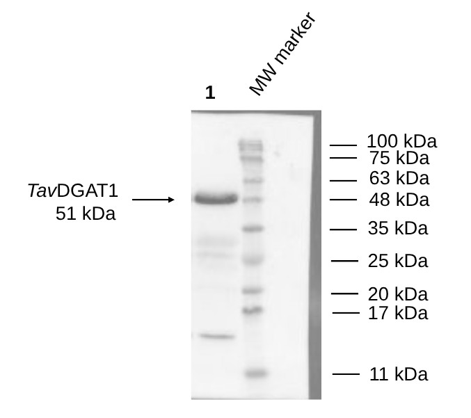 Western blot using anti-DGAT1 antibodies
