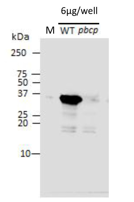Western blot using anti-PBCP antibodies