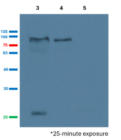 Western blot detection of aconitase in grapevine