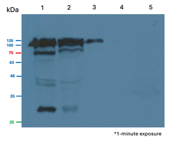 Western blot using anti- plant Aconitase antibodies