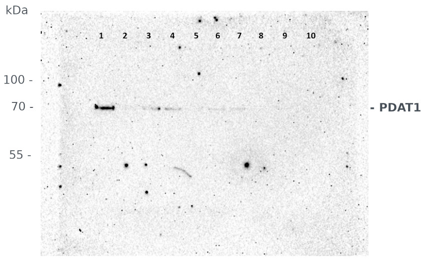 Western blot using anti plant PDAT1 antibodies