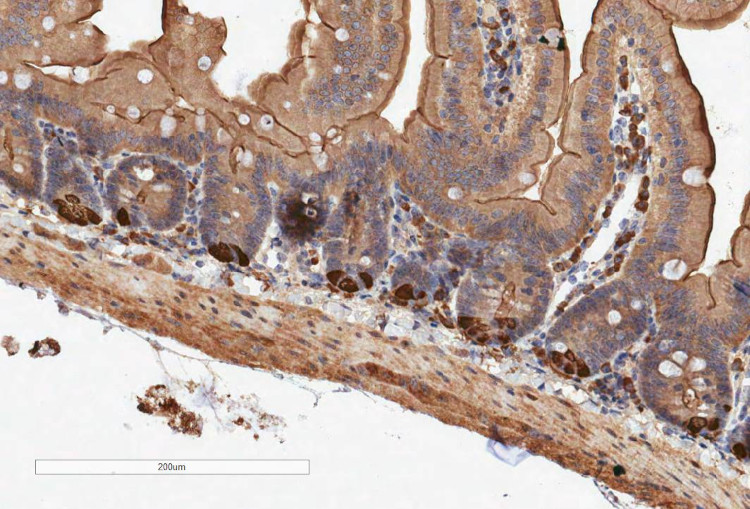 IHC in mouse intenstinal tissue