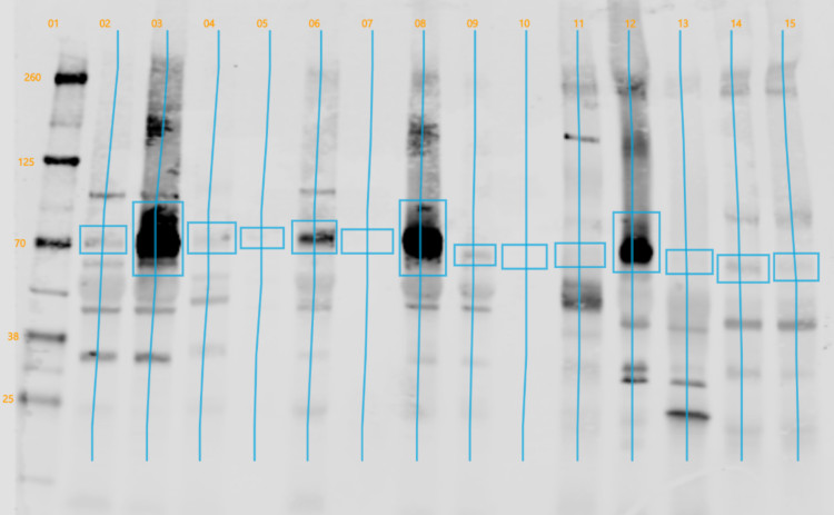 Western blot with anti-ZEP antibodies on various plant extracts