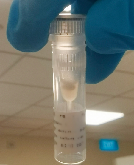 Aggregated antibody