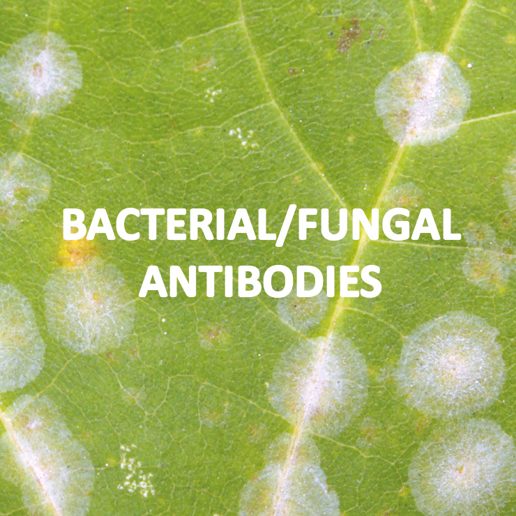 Primary antibodies, Human/animal