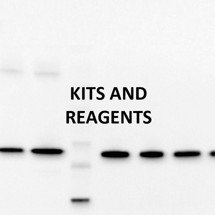 Antibody production