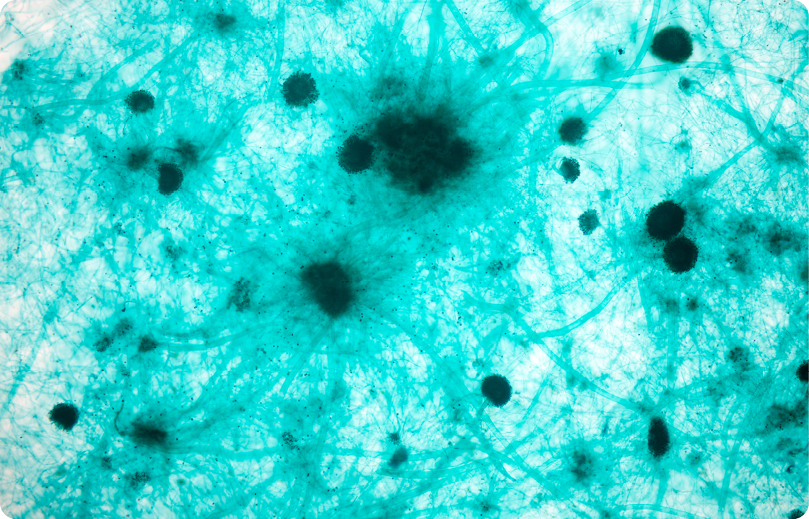 Agrisera plant toxin antibodies