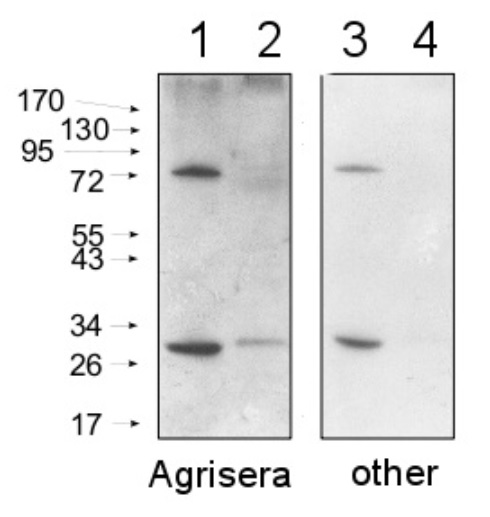 Secondary antibody comparison