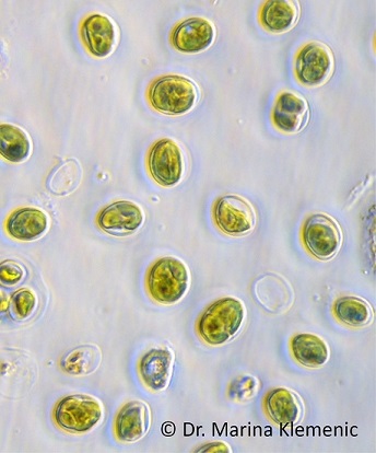 Algal cells
